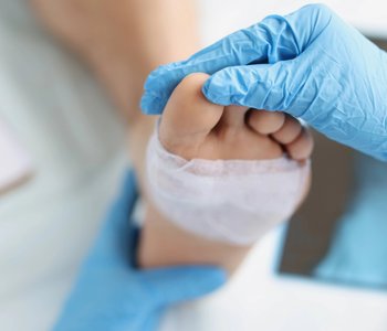 What to Expect After Bunion Surgery Abroad