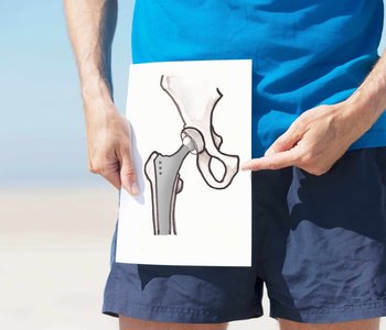 Total vs Partial Hip Replacement vs Resurfacing